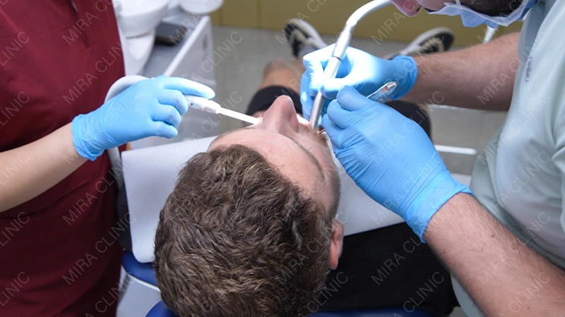 Hollywood smile Treatment Expectations vs Reality